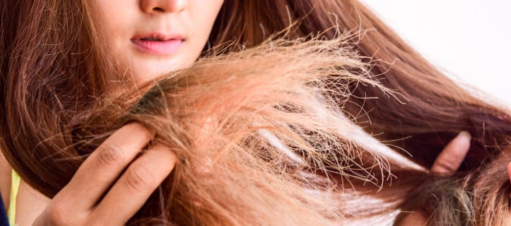 Agar Lebih Berkilau, Ini 8 Cara Mengatasi Rambut Kering ...
