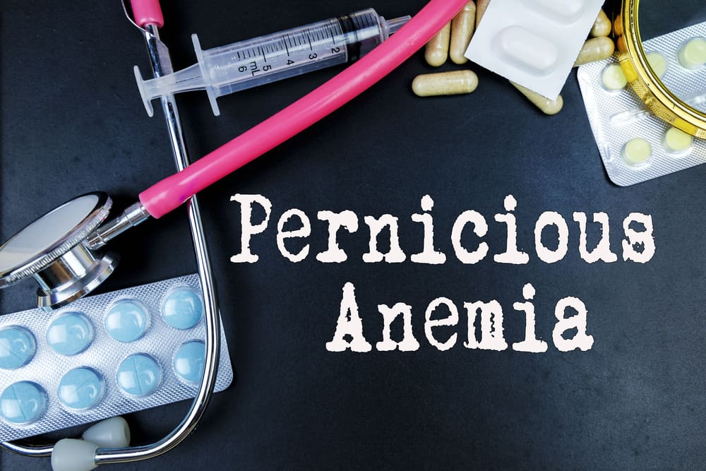 Mengenal Penyakit Pernicious Anemia: Penyebab, Gejala hingga