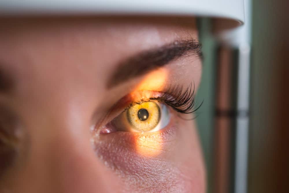 penyebab glaukoma mata
