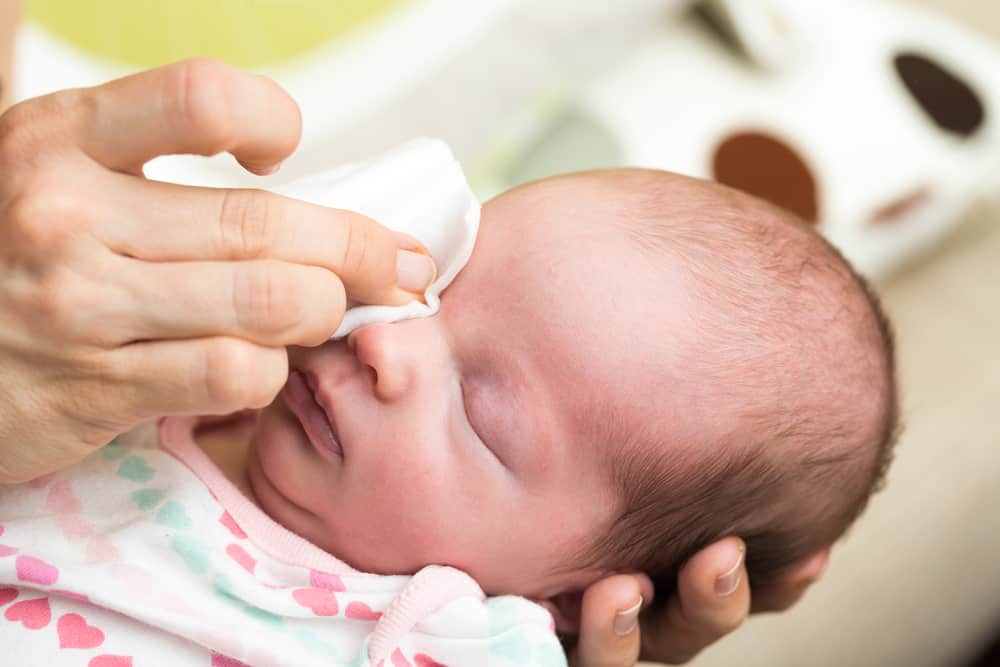  Mata Bayi  Belekan Bikin Panik Yuk Cari Tahu Berbahaya 